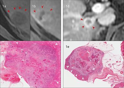 Comprehensive Imaging Characterization of Colorectal Liver Metastases